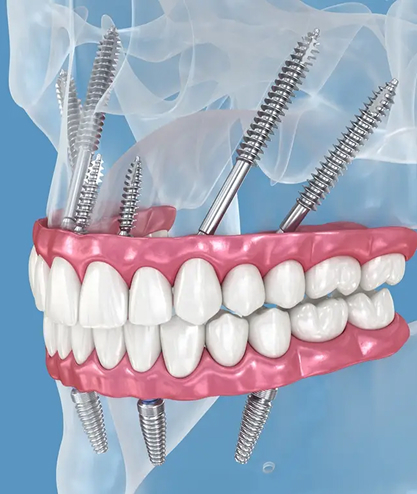 Teeth images